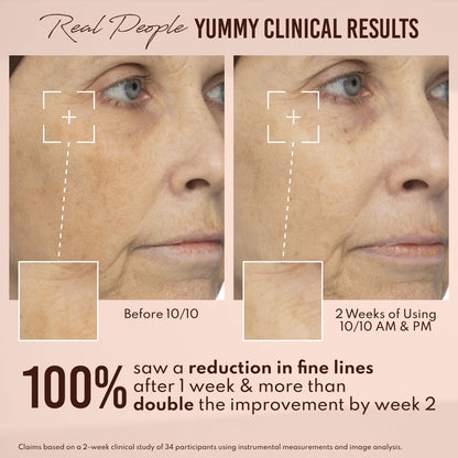 Yummy Skin 10/10 Barrier Boost Hyaluronic Acid + Ectoin Plumping Serum